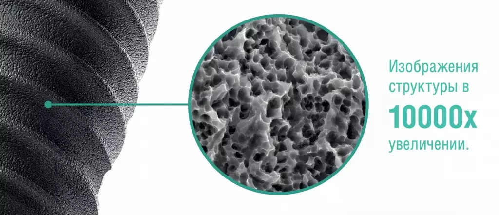 структура имплантов Баерс