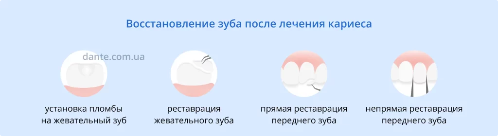 Восстановление зуба после лечения кариеса