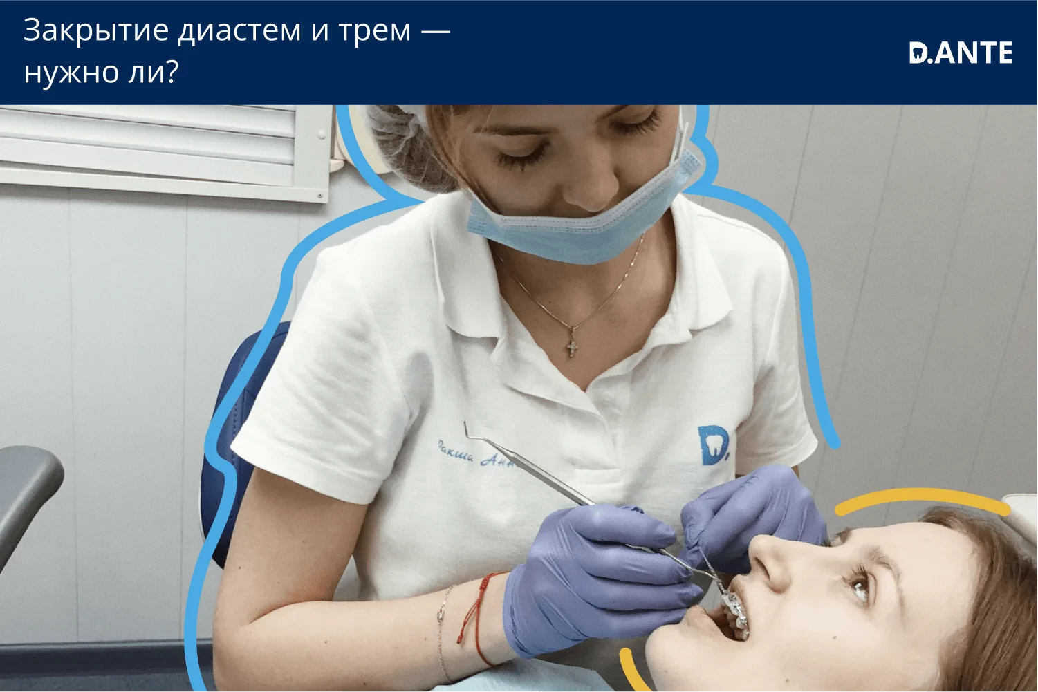 Нужно ли закрывать диастемы и тремы | D.Ante