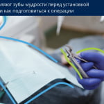 Удаление зубов мудрости перед установкой брекетов