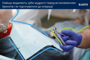 Видалення зубів мудрості перед установкою брекетів