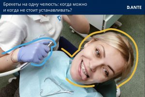 когда ставят брекеты на одну челюсть