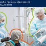 гранулема зуба: что делать