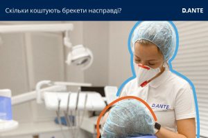 Скільки коштують брекети насправді?