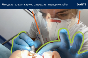 кариес передних зубов