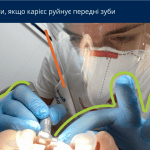 карієс передніх зубів