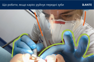 карієс передніх зубів