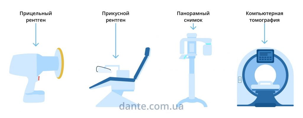 виды рентгена