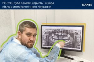 рентген зуба в Києві