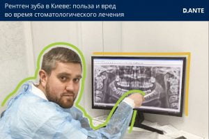 Рентген зуба в Киеве