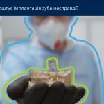 Скільки насправді коштує імплантація зуба?