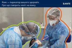 Наліт на язику