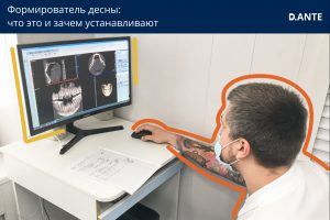Что такое формирователь десны