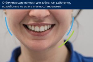 как действуют отбеливающие полоски