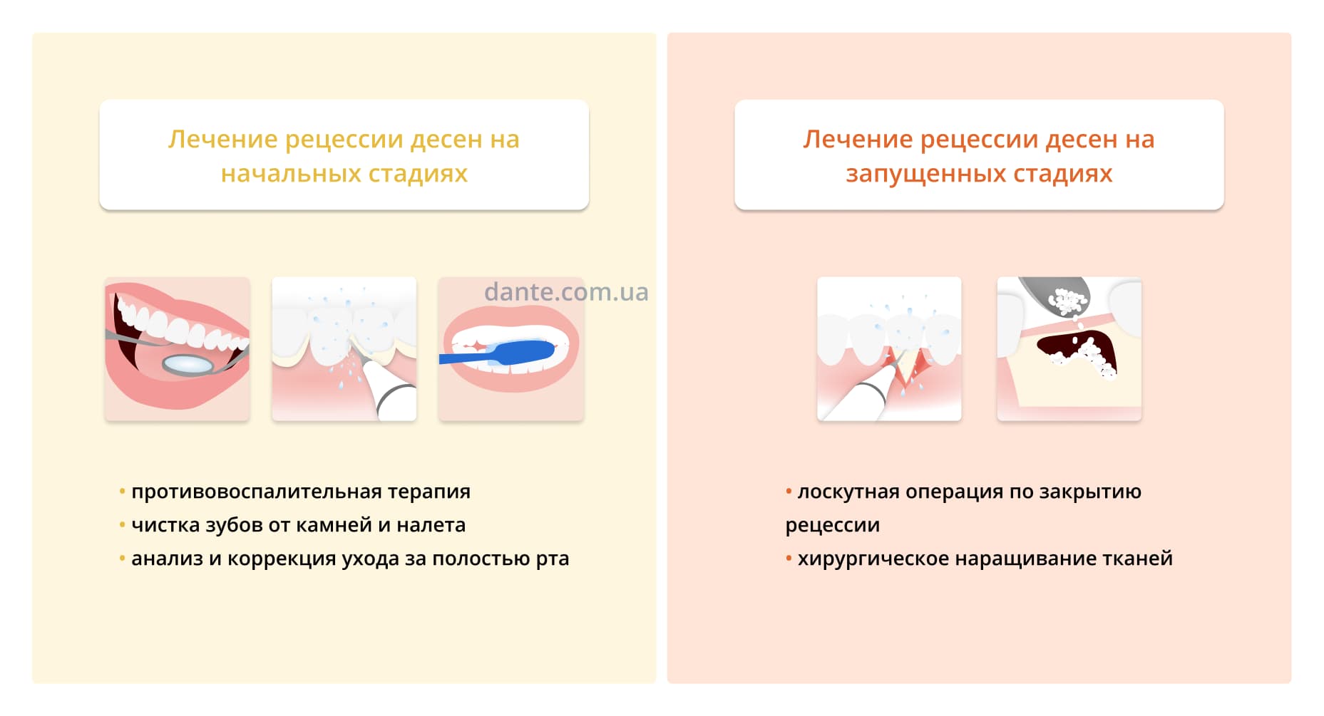 * как лечат рецессию десен в зависимости от стадии патологии