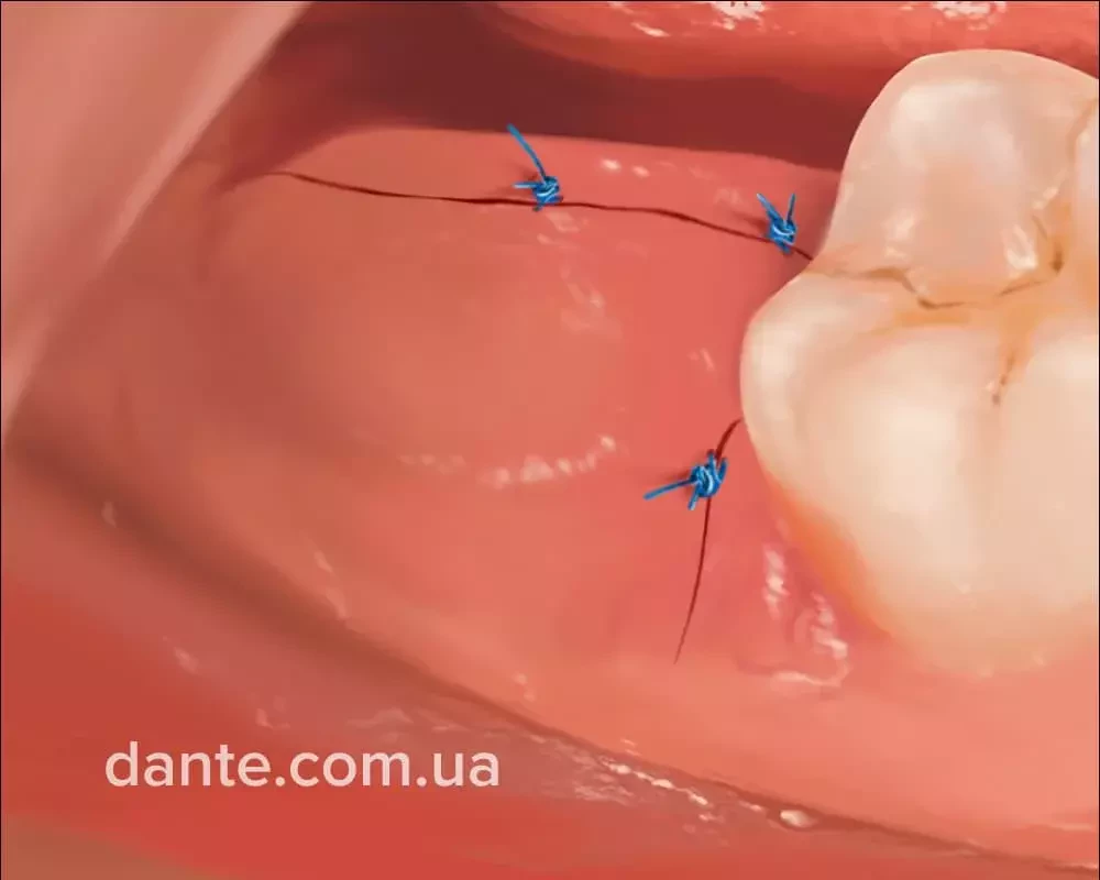 Хирургическая стоматология