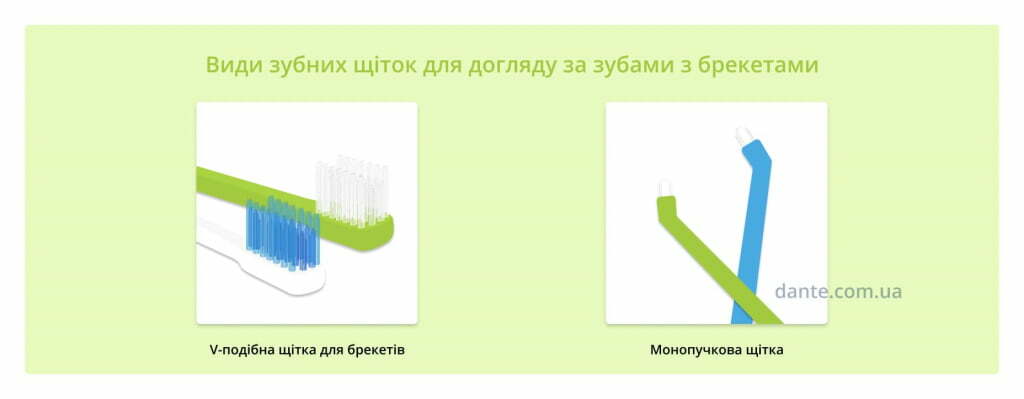 щітки для брекетів