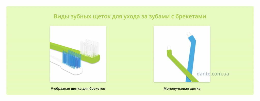 щетки для брекетов
