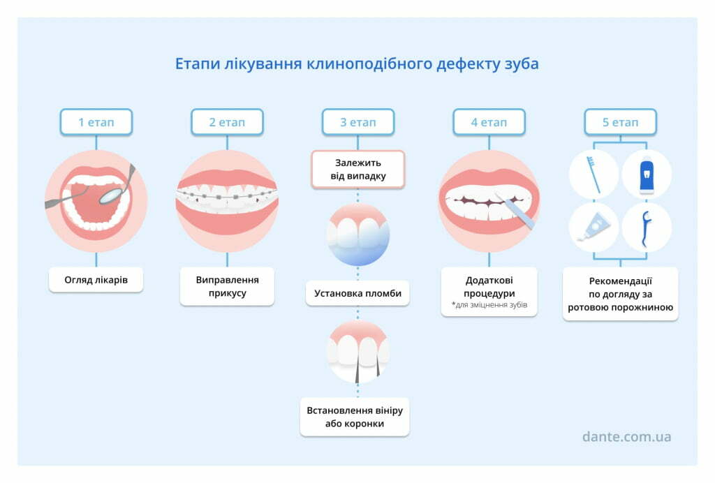 клиноподібний дефект зубів лікування