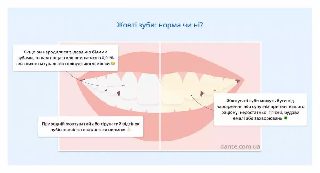 Способи лікування прозорості зубів