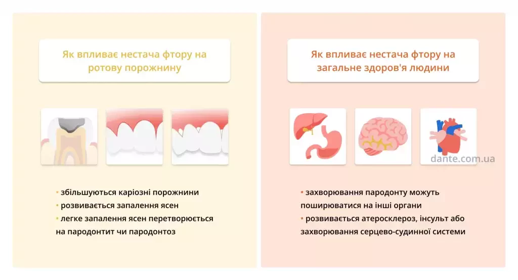 Як вприває нестача фтору на ротову порожнину