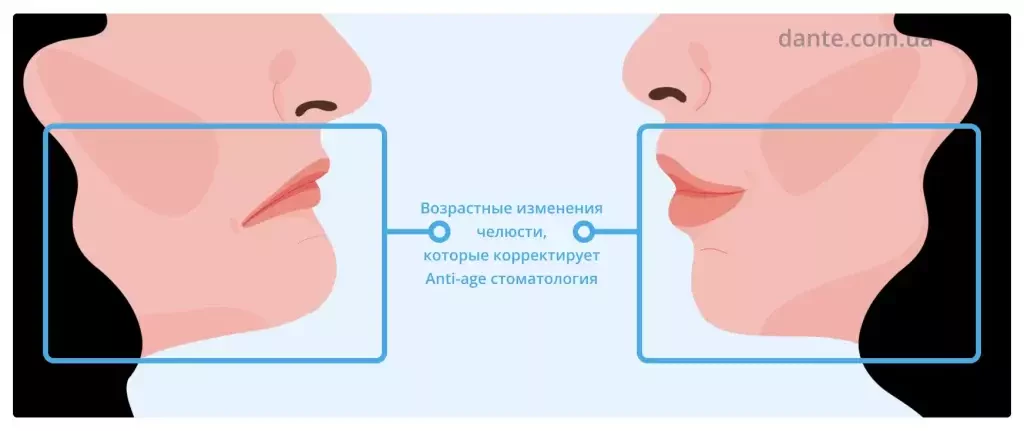 Что такое Anti-age стоматология