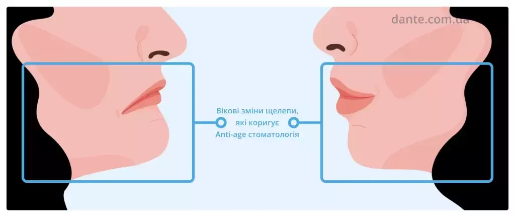 Що таке Anti-age стоматологія