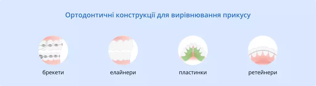 Брекети, елайнери, пластинки для дітей та ретейнери | Ортодонтія | Стоматологія D.Ante