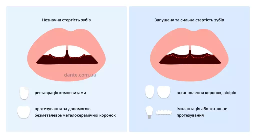 стирання зубів: як відновлюють зуби