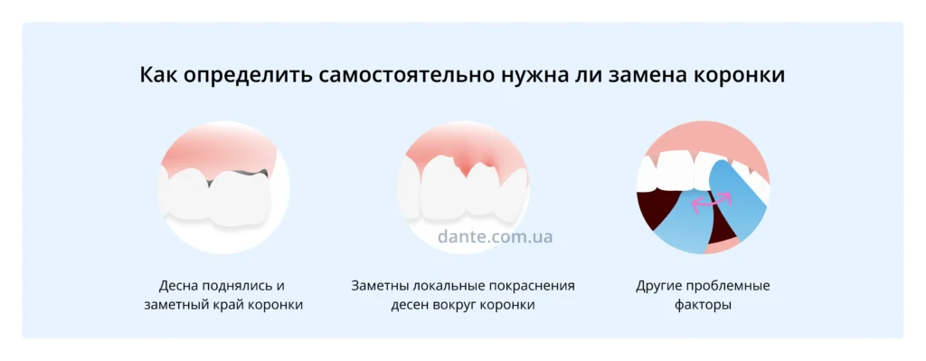 проблемы с коронкой зуба