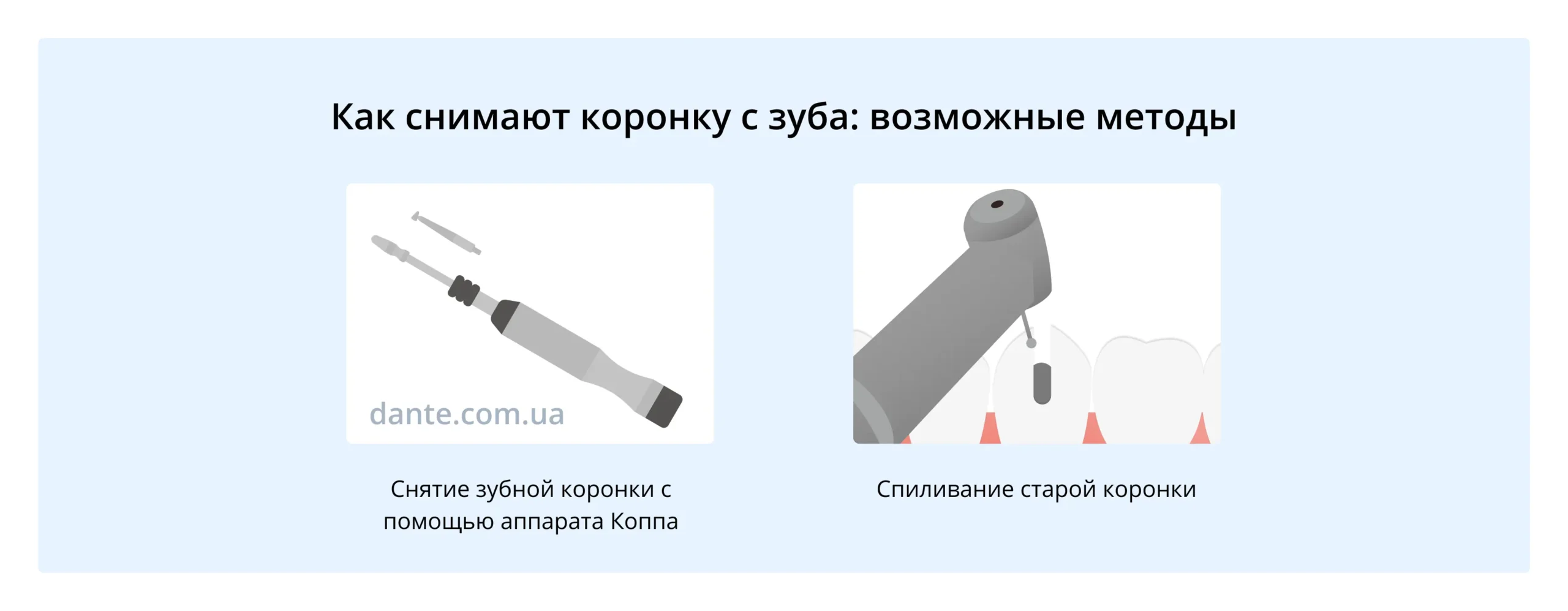 снятие коронки зуба