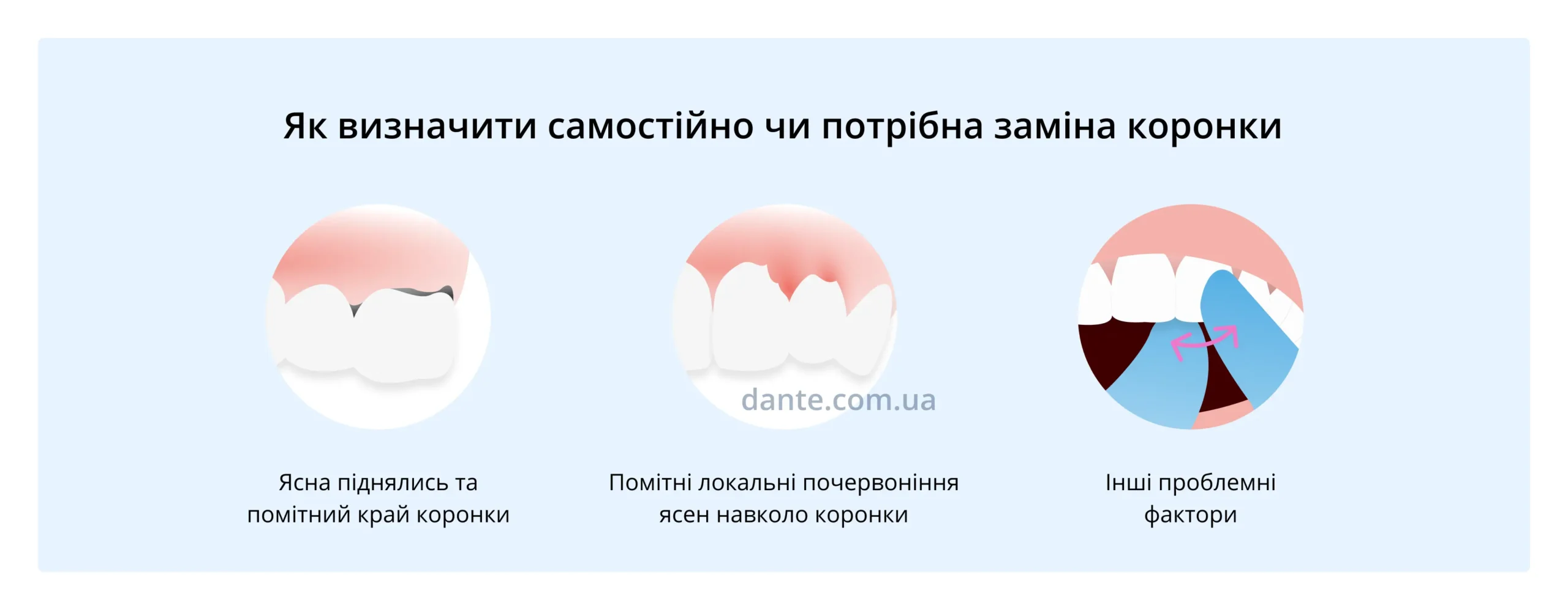 проблеми з коронкою зуба
