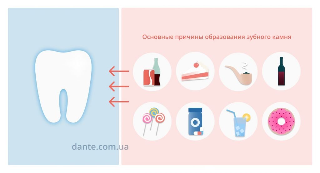 камни на зубах причины