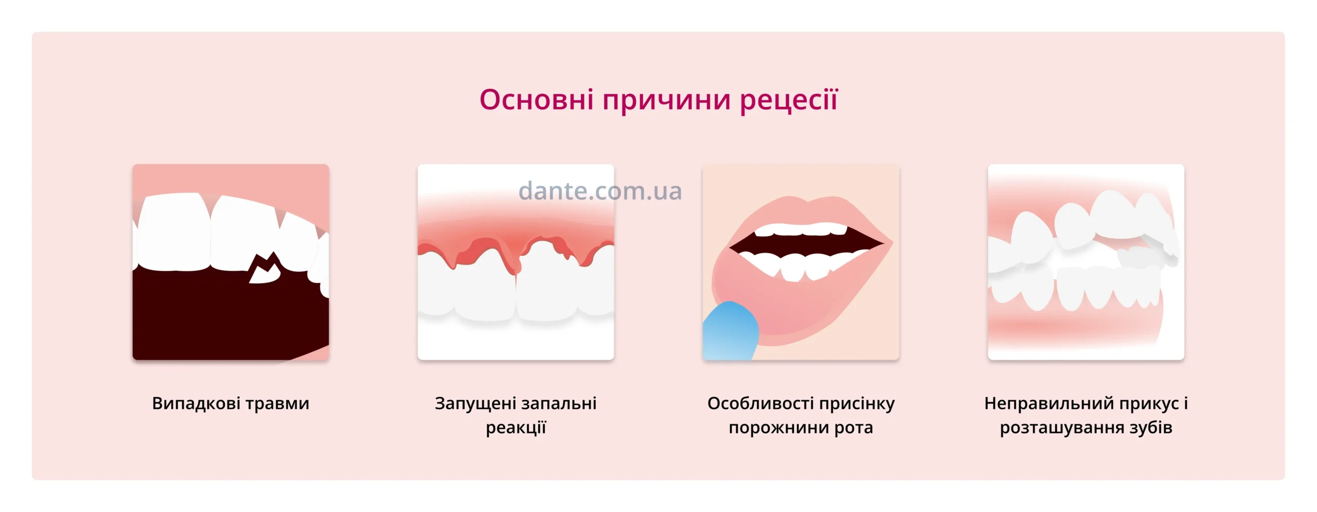 Чому розвивається рецесія ясен: головні причини рецесії